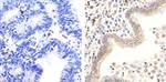 Phospho-Rb (Thr826) Antibody in Immunohistochemistry (Paraffin) (IHC (P))