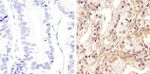 AKT Pan Antibody in Immunohistochemistry (Paraffin) (IHC (P))