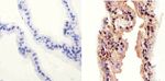 AKT Pan Antibody in Immunohistochemistry (Paraffin) (IHC (P))