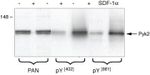 Phospho-PYK2 (Tyr402) Antibody