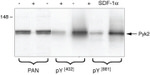 Phospho-PYK2 (Tyr402) Antibody in Western Blot (WB)