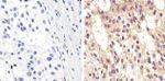 Phospho-AKT1 (Ser473) Antibody in Immunohistochemistry (Paraffin) (IHC (P))