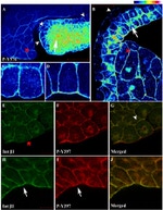 Phospho-FAK (Tyr576) Antibody in Immunocytochemistry (ICC/IF)