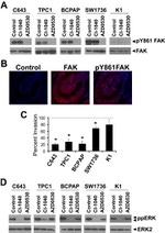 Phospho-FAK (Tyr861) Antibody in Western Blot, Immunocytochemistry, Immunohistochemistry (Paraffin) (WB, ICC/IF, IHC (P))