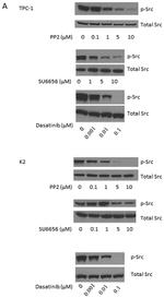 Phospho-FAK (Tyr861) Antibody in Western Blot (WB)