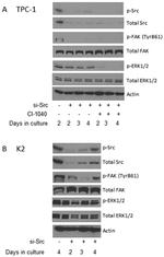 Phospho-FAK (Tyr861) Antibody in Western Blot (WB)