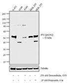 Phospho-p53 (Ser392) Antibody in Western Blot (WB)