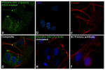 Phospho-SRC (Tyr419) Antibody in Immunocytochemistry (ICC/IF)