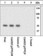 Phospho-CaMKII alpha (Thr286) Antibody in Western Blot (WB)