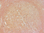 PARP1 (cleaved Asp214, Asp215) Antibody in Immunohistochemistry (Paraffin) (IHC (P))