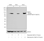 PARP1 (cleaved Asp214, Asp215) Antibody in Western Blot (WB)