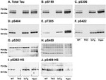 Phospho-Tau (Thr205) Antibody in Western Blot (WB)