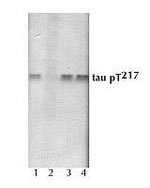 Phospho-Tau (Thr217) Antibody in Western Blot (WB)