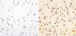 Phospho-Tau (Thr217) Antibody in Immunohistochemistry (Paraffin) (IHC (P))