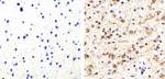 Phospho-Tau (Thr231) Antibody in Immunohistochemistry (Paraffin) (IHC (P))