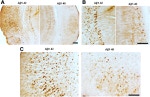 Phospho-Tau (Ser262) Antibody in Immunohistochemistry (IHC)