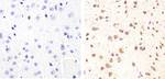 Phospho-Tau (Ser409) Antibody in Immunohistochemistry (Paraffin) (IHC (P))