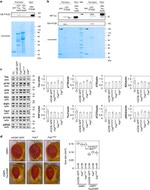 Phospho-Tau (Ser422) Antibody in Western Blot (WB)