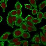 Moesin Antibody in Immunocytochemistry (ICC/IF)