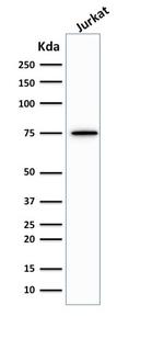 Moesin Antibody in Western Blot (WB)