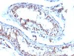 Moesin Antibody in Immunohistochemistry (Paraffin) (IHC (P))