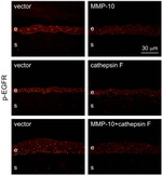 Phospho-EGFR (Tyr845) Antibody in Immunohistochemistry (IHC)