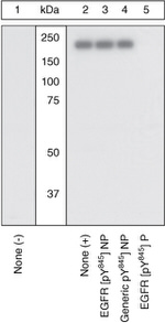 Phospho-EGFR (Tyr845) Antibody in Western Blot (WB)