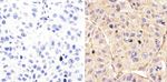 Phospho-EGFR (Tyr992) Antibody in Immunohistochemistry (Paraffin) (IHC (P))