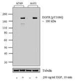 Phospho-EGFR (Tyr1086) Antibody in Western Blot (WB)