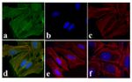 Phospho-EGFR (Tyr1173) Antibody