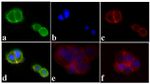 Phospho-IR/IGF1R (Tyr1162, Tyr1163) Antibody in Immunocytochemistry (ICC/IF)