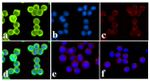 Phospho-INSR (Tyr1328) Antibody