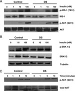 Phospho-IRS1 (Tyr612) Antibody in Western Blot (WB)