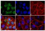 Phospho-p70 S6 Kinase (Thr229) Antibody