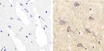 Phospho-RSK1 (Ser221) Antibody in Immunohistochemistry (Paraffin) (IHC (P))