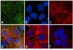 Phospho-PKC alpha (Thr638) Antibody in Immunocytochemistry (ICC/IF)