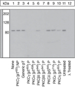 Phospho-PKC gamma (Thr655) Antibody in Western Blot (WB)