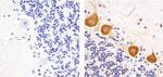 Phospho-PKC gamma (Thr655) Antibody in Immunohistochemistry (Paraffin) (IHC (P))