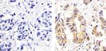 Phospho-PKC delta (Ser664) Antibody in Immunohistochemistry (Paraffin) (IHC (P))