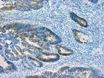 FXN Antibody in Immunohistochemistry (IHC)