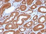 MTAP Antibody in Immunohistochemistry (Paraffin) (IHC (P))