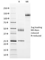 MUC1/CA15-3/EMA/CD227 (Epithelial Marker) Antibody in SDS-PAGE (SDS-PAGE)