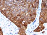 MUC1/CA15-3/EMA/CD227 (Epithelial Marker) Antibody in Immunohistochemistry (Paraffin) (IHC (P))