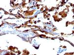 MUC1/CA15-3/EMA/CD227 (Epithelial Marker) Antibody in Immunohistochemistry (Paraffin) (IHC (P))