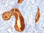 MUC1/CA15-3/EMA/CD227 (Epithelial Marker) Antibody in Immunohistochemistry (Paraffin) (IHC (P))