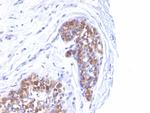 MUC1/CA15-3/EMA/CD227 (Epithelial Marker) Antibody in Immunohistochemistry (Paraffin) (IHC (P))