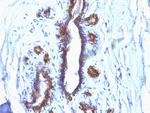 MUC1/CA15-3/EMA/CD227 (Epithelial Marker) Antibody in Immunohistochemistry (Paraffin) (IHC (P))