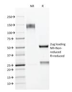 MUC1/CA15-3/EMA/CD227 (Epithelial Marker) Antibody in SDS-PAGE (SDS-PAGE)