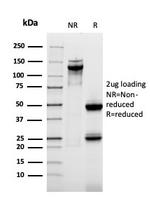 MUC1/CA15-3/EMA/CD227 Antibody in SDS-PAGE (SDS-PAGE)