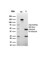 MUC1/CA15-3/EMA/CD227 (Epithelial Marker) Antibody in SDS-PAGE (SDS-PAGE)